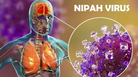 Azərbaycanda "Nipah"a yoluxma qeydə alınmayıb - RƏSMİ