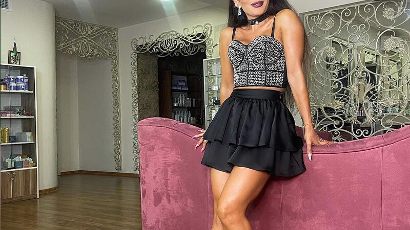 Azərbaycanlı müğənniyə itlər HÜCUM ÇƏKDİ: "Qollarımda, belimdə yaralar var, yerlə sürüdülər"