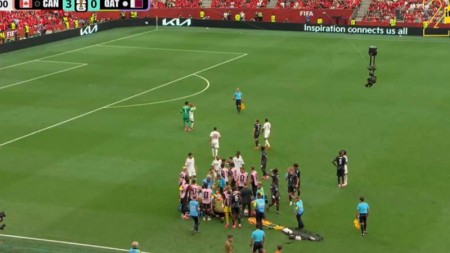 DÇ matçında futbolçunun ayağı sındı - Dəhşətli anlar - VİDEO