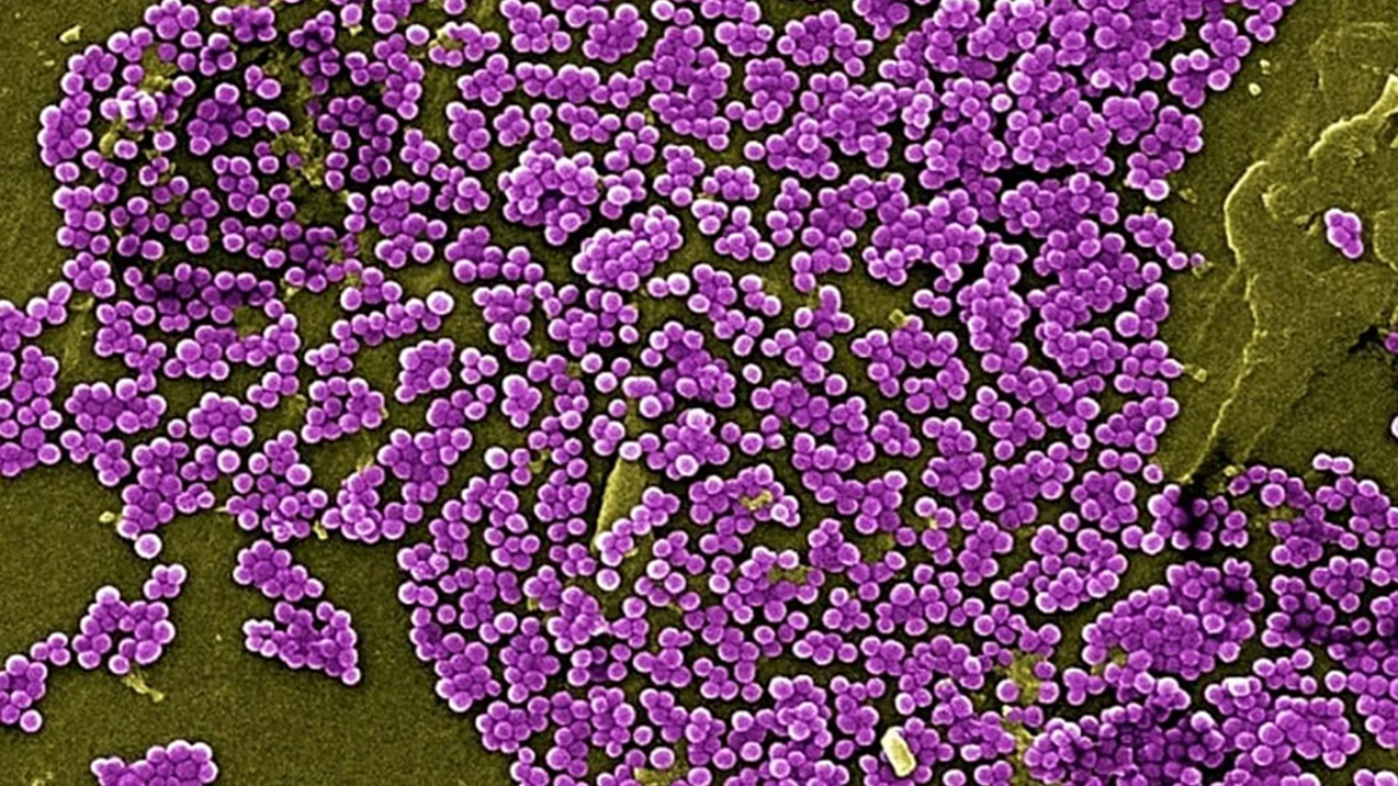 Antibiotiksiz müalicə üsulu tapıldı
